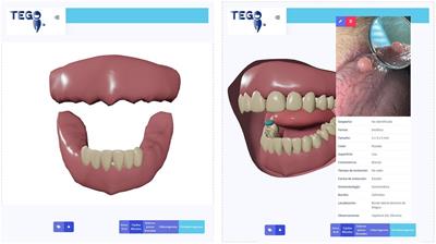 A rural teledentistry care experience: a geriatric approach to assessing oral health status and treatment needs in older adults from a Mapuche community in Chile